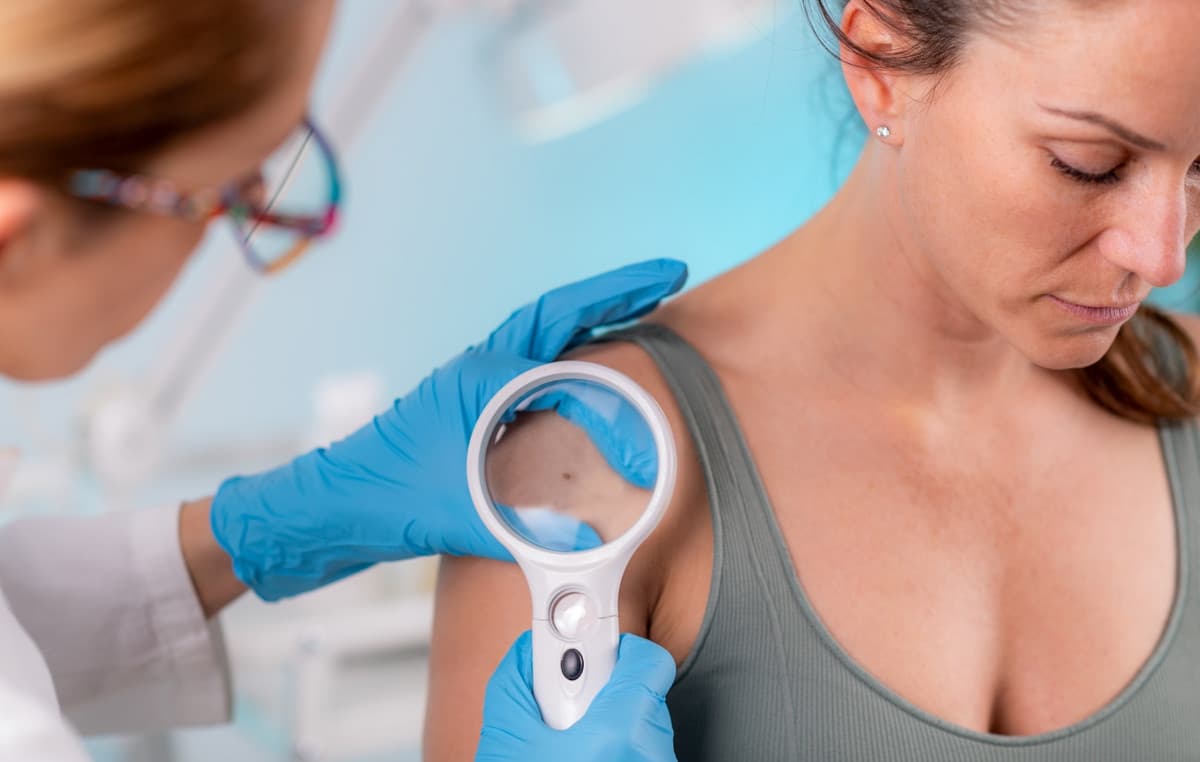 Ο καρκίνος του δέρματος και το σημάδι που δεν πρέπει να αγνοείς