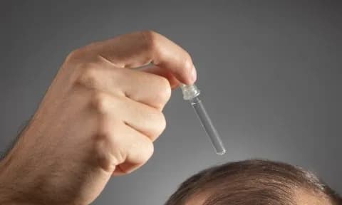 Ο φυτικός ορός από την Κίνα που υπόσχεται τέλος στη φαλάκρα