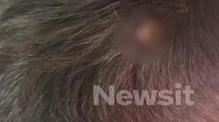 Συνελήφθη ο παίκτης Survivor για ξυλοδαρμό 14χρονου