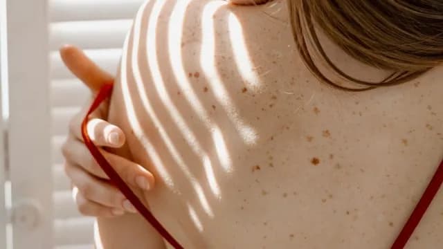 Η La Roche-Posay στηρίζει ογκολογικούς ασθενείς στην Ελλάδα