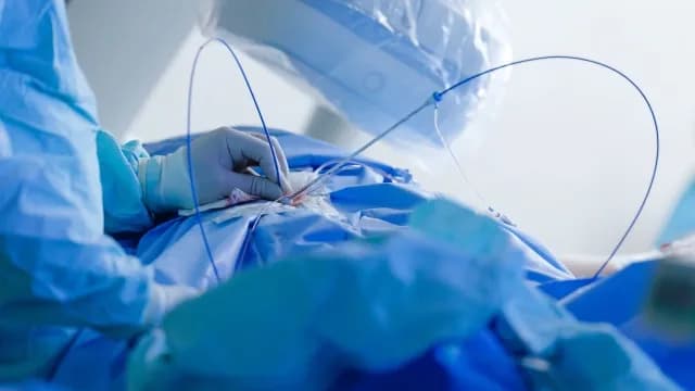 Η τεχνητή νοημοσύνη «διαβάζει» την καρδιά πριν νοσήσει