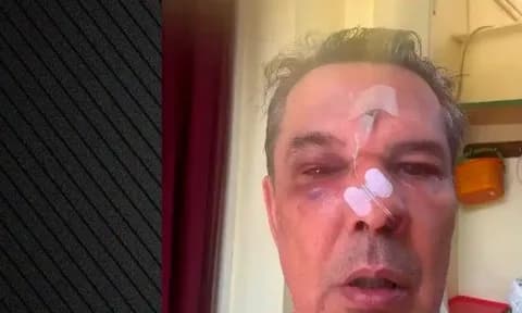 Χαϊδάρι: Άγριο ξύλο σε ιατρείο επειδή ζήτησε να μιλήσει πιο σιγά