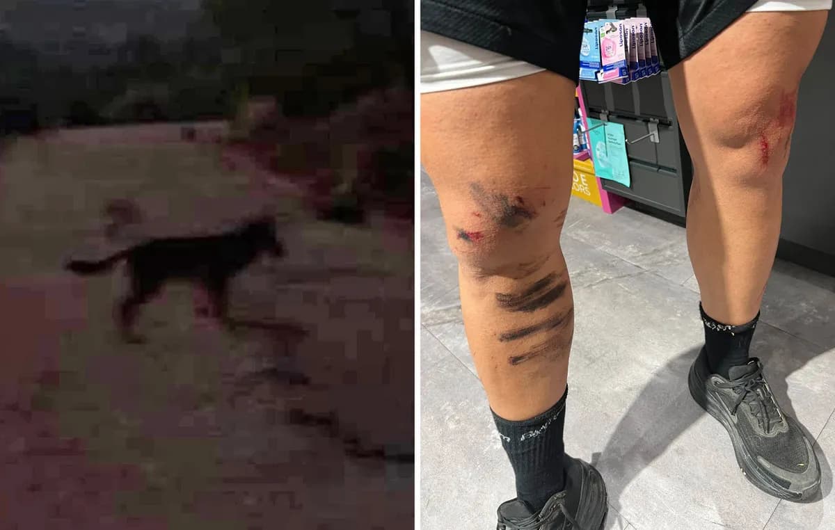 Ο λύκος επιτέθηκε σε κάτοικο του Κρυονερίου Αττικής