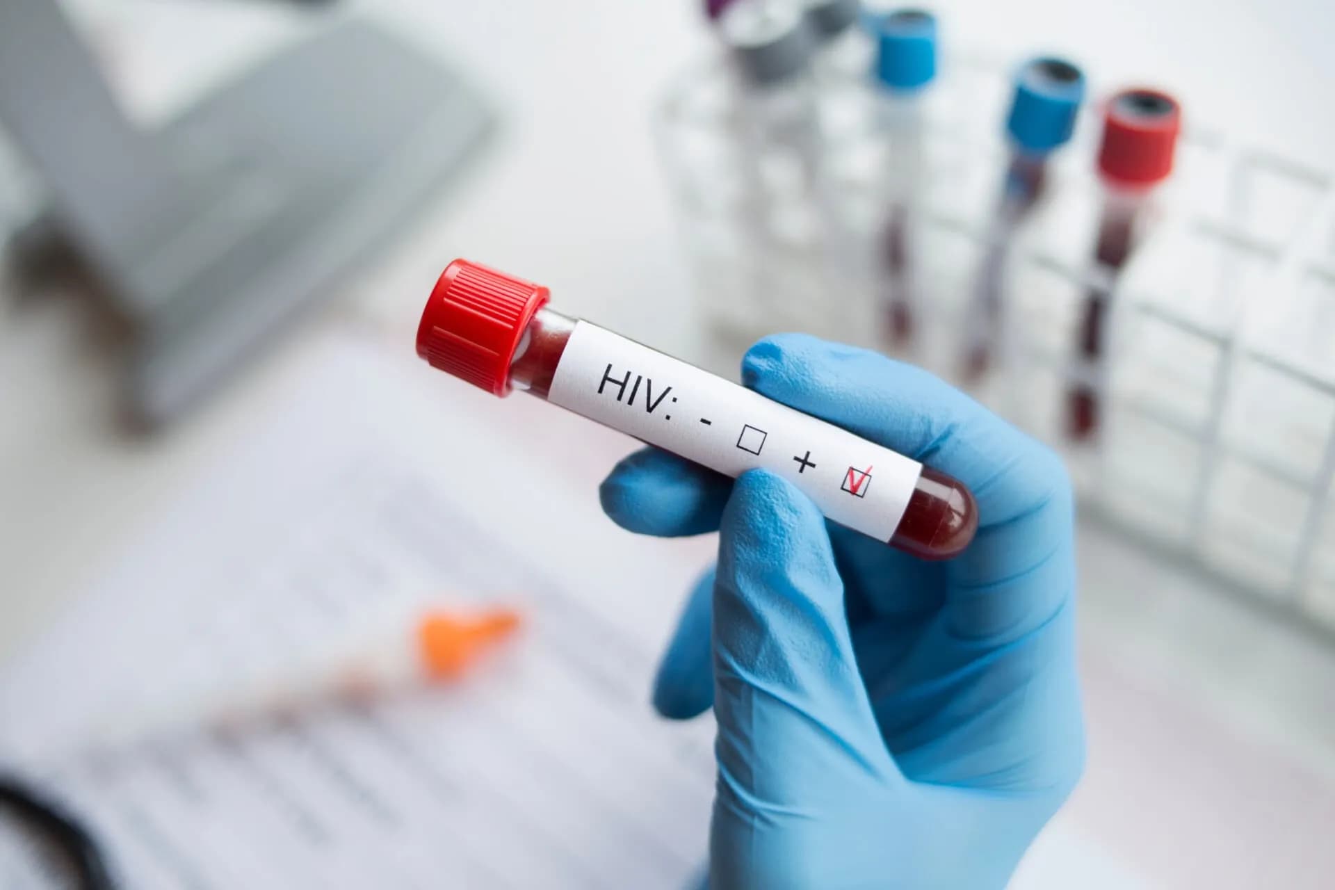 Πείραμα στις ΗΠΑ πέτυχε έλεγχο του HIV χωρίς φάρμακα