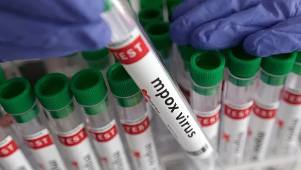 ασθενής mpox νοσοκομείο Ιωαννίνων απομόνωση 2026