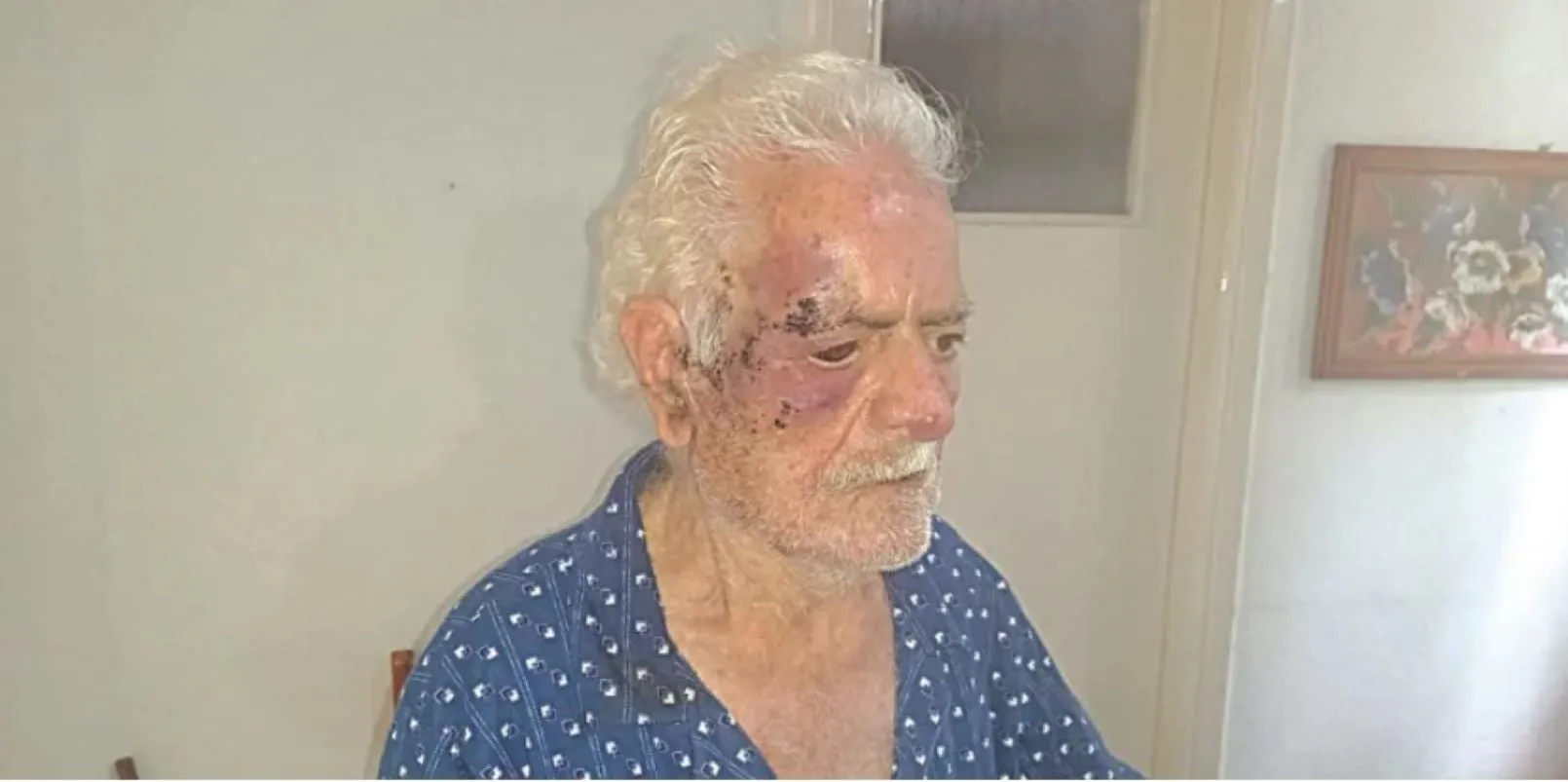 Πλατεία Μπακογιάννη Πάτρα ληστεία ηλικιωμένο ζευγάρι