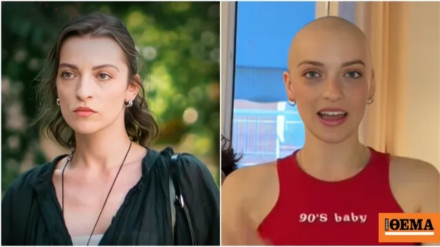 Η ηθοποιός Εβίτα Αγαΐτση με ξυρισμένο κεφάλι μετά τη διάγνωση καρκίνου