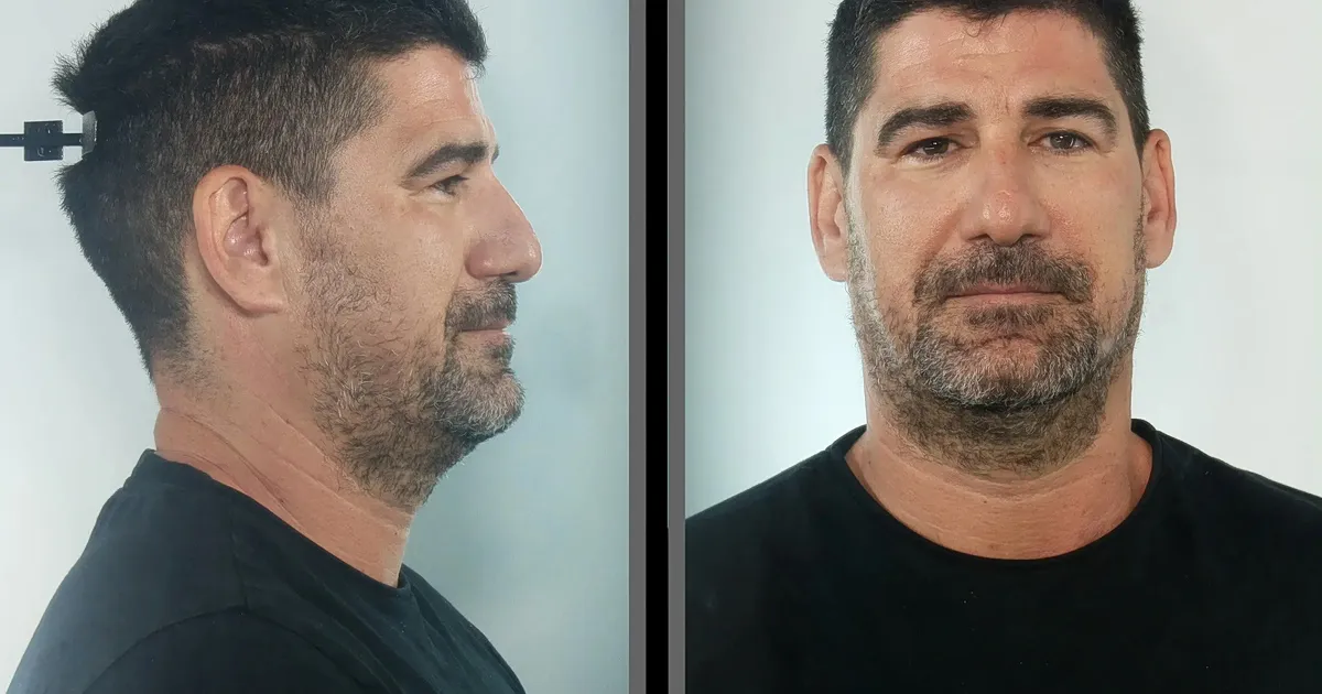 Αστυνομία Κεφαλονιά έρευνα προπονητή βιασμό ανηλίκων
